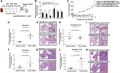 Liver Kinase B1 Regulates Remodeling of the Tumor Microenvironment in Triple-Negative Breast Cancer